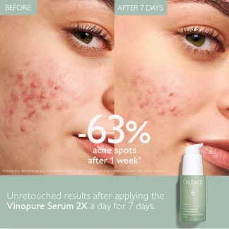 Caudalie (Кодалі) Vinopure Сироватка контроль недосконалості 30мл (44541) Caudalie (Кодалі) Vinopure Сироватка контроль недосконалості 30мл (44541)-1