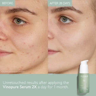 Caudalie (Кодалі) Vinopure Сироватка контроль недосконалості 30мл (44541) Caudalie (Кодалі) Vinopure Сироватка контроль недосконалості 30мл (44541)-7