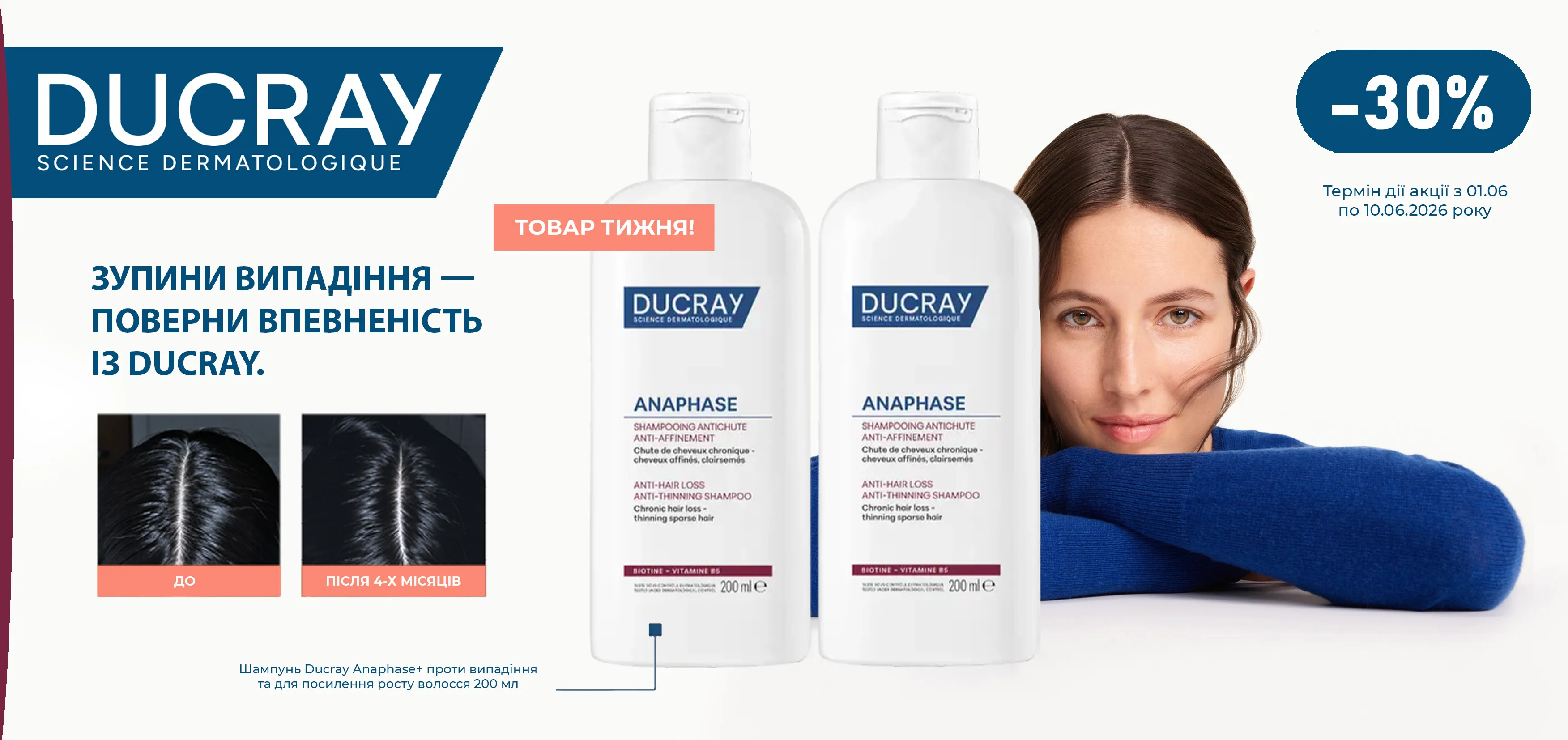 Акція червень Ducray Anaphase